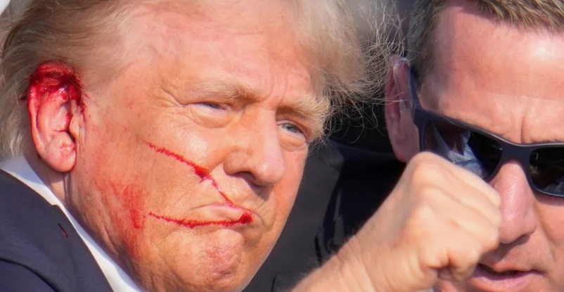 Дональд Трамп раненный